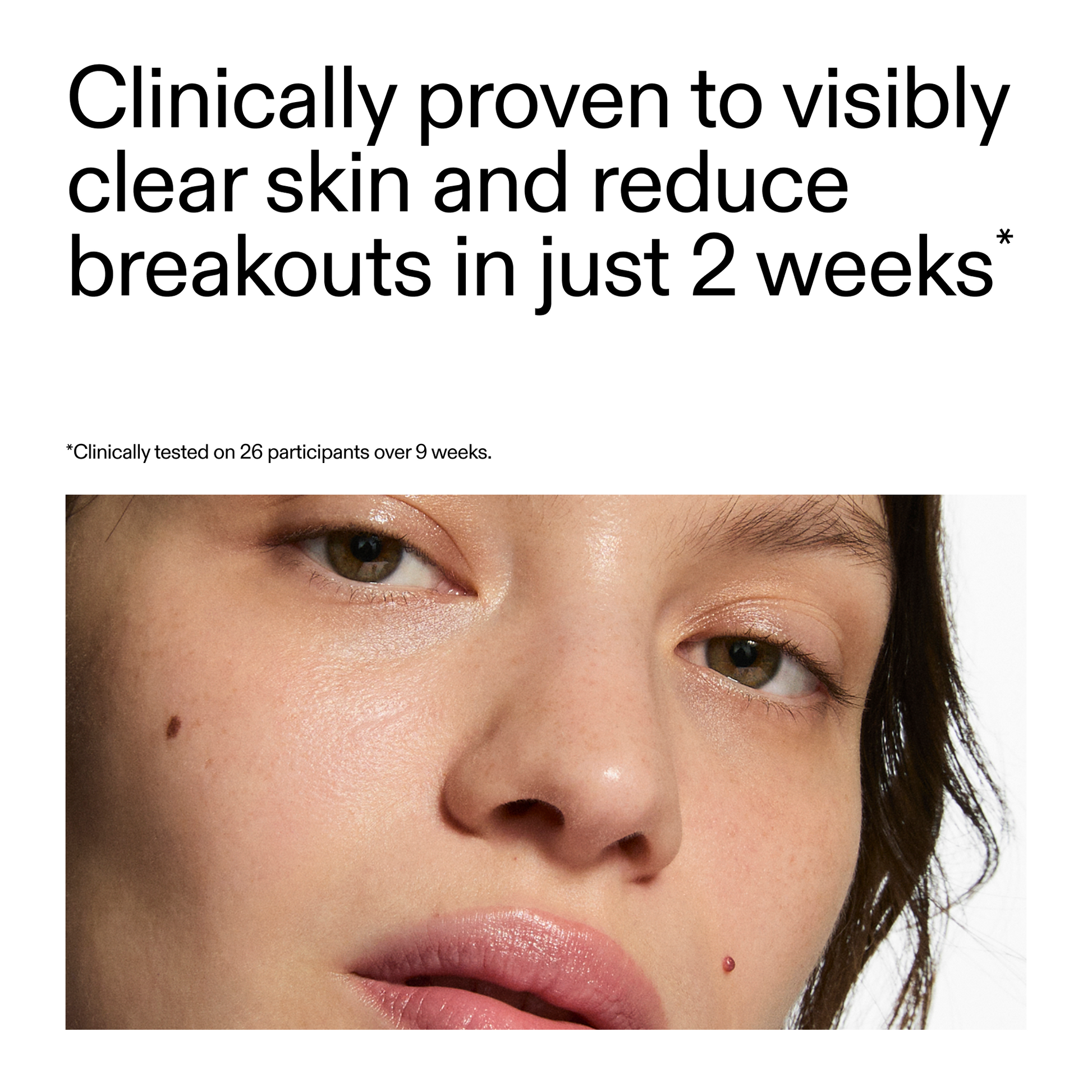 360-acne-clearing-serum-f4 360_Serum_Key_Claim.png