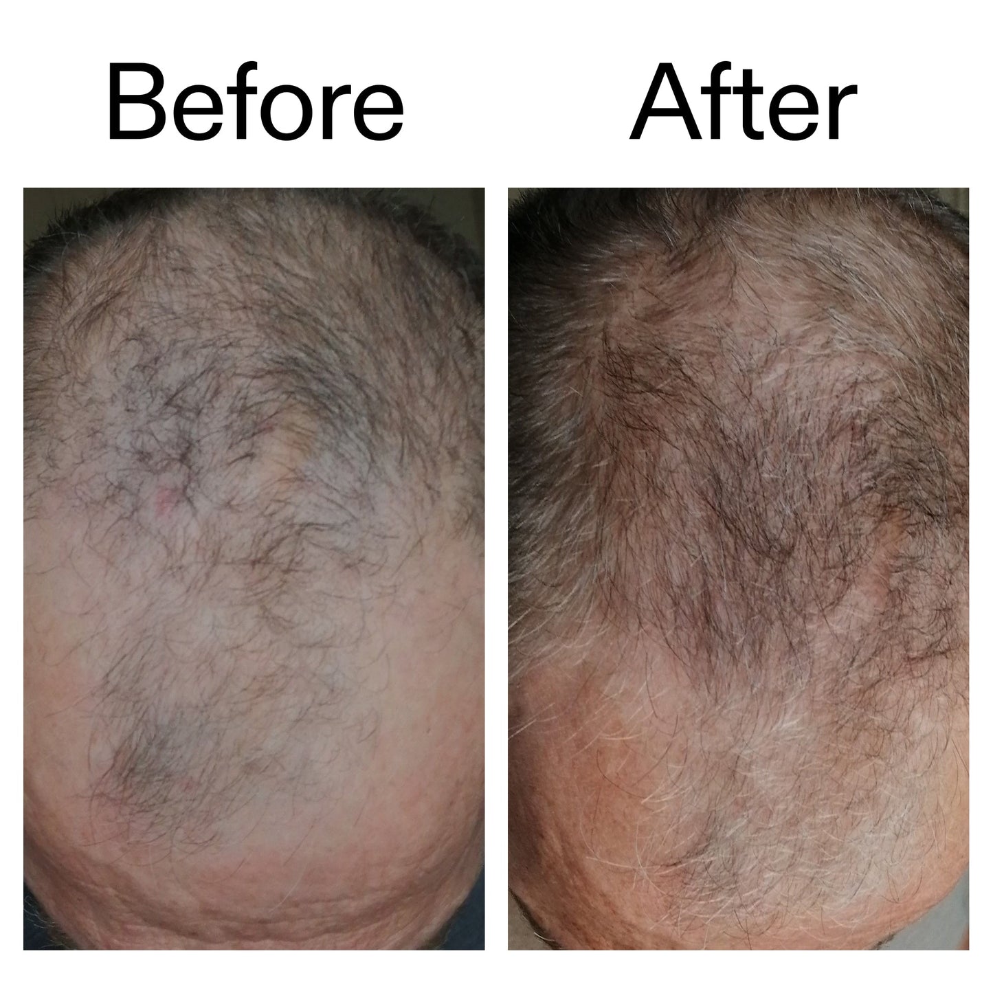 3-month-hair-growth-trio-m6 Caffeine_Scalp_Treatment_B_A_Ppage_2000_x_2000.jpg