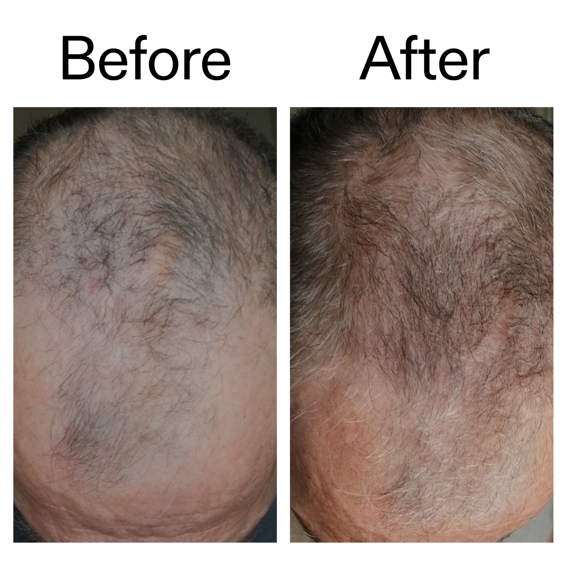 3-month-hair-growth-trio-m6 Caffeine_Scalp_Treatment_B_A_Ppage_2000_x_2000.jpg