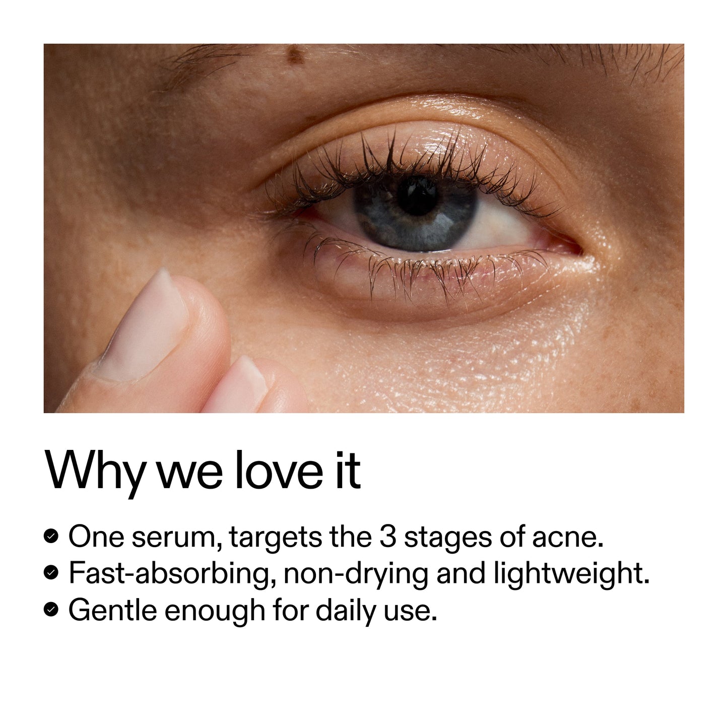 360-acne-clearing-serum-f4 Dioic_Whyweloveit_2000x2000_175aafd3-0cbe-403a-b317-a8362881bfe2.jpg