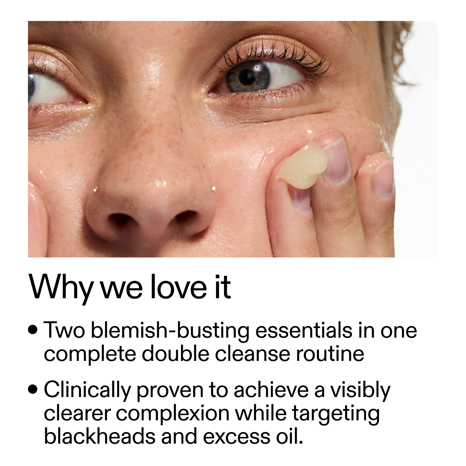 acne-double-cleanse-duo-b1 Double_Cleanse_Duo_for_Breakouts_Why_We_2000x2000_f242cb12-bb5c-487c-b203-071ccb406ec5.png