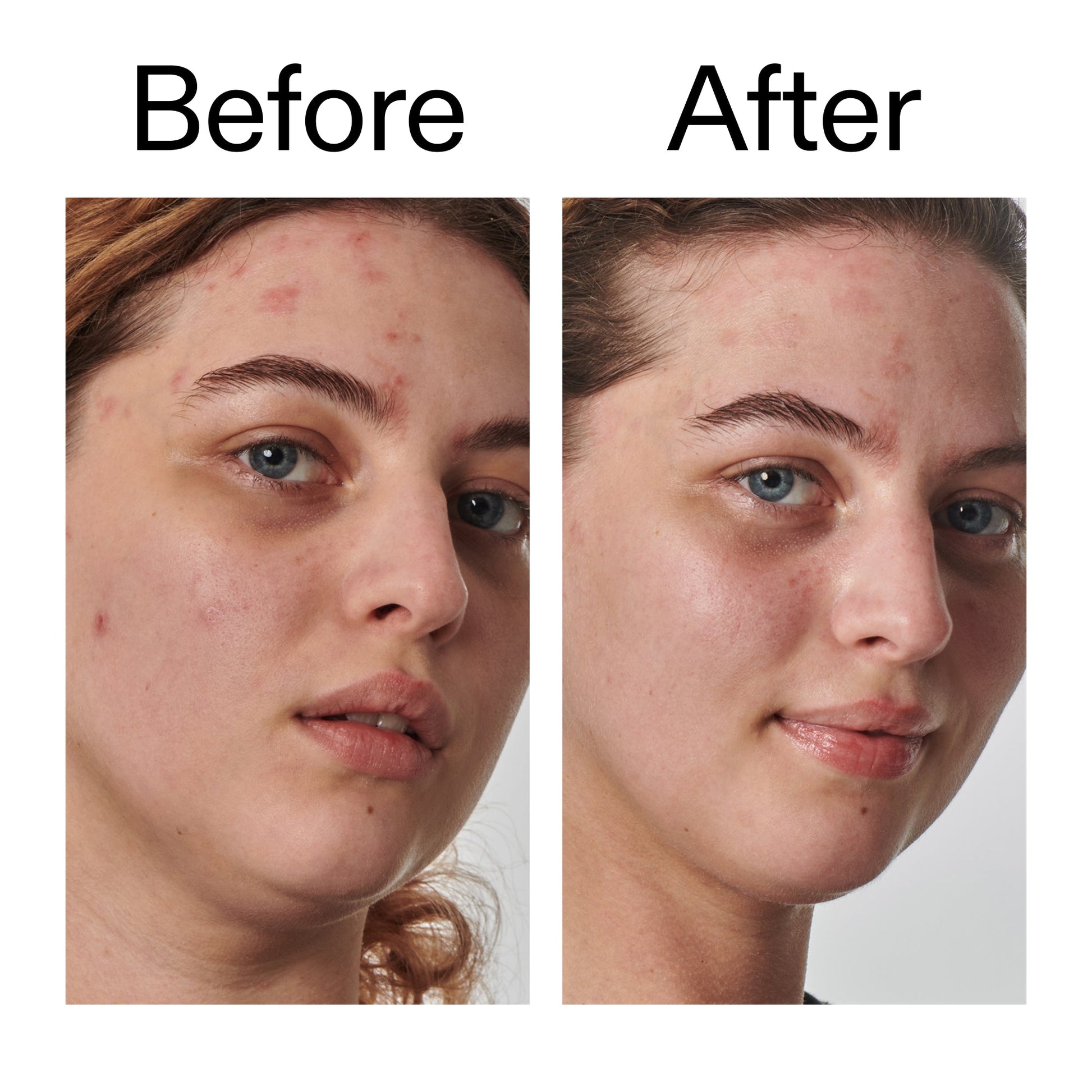 10-urea-moisturizer-t0 Dry_and_Rough_Skin_Solution_Before_After_2000x2000_efa6e639-5c39-49bd-a5dd-f0220293120a.jpg