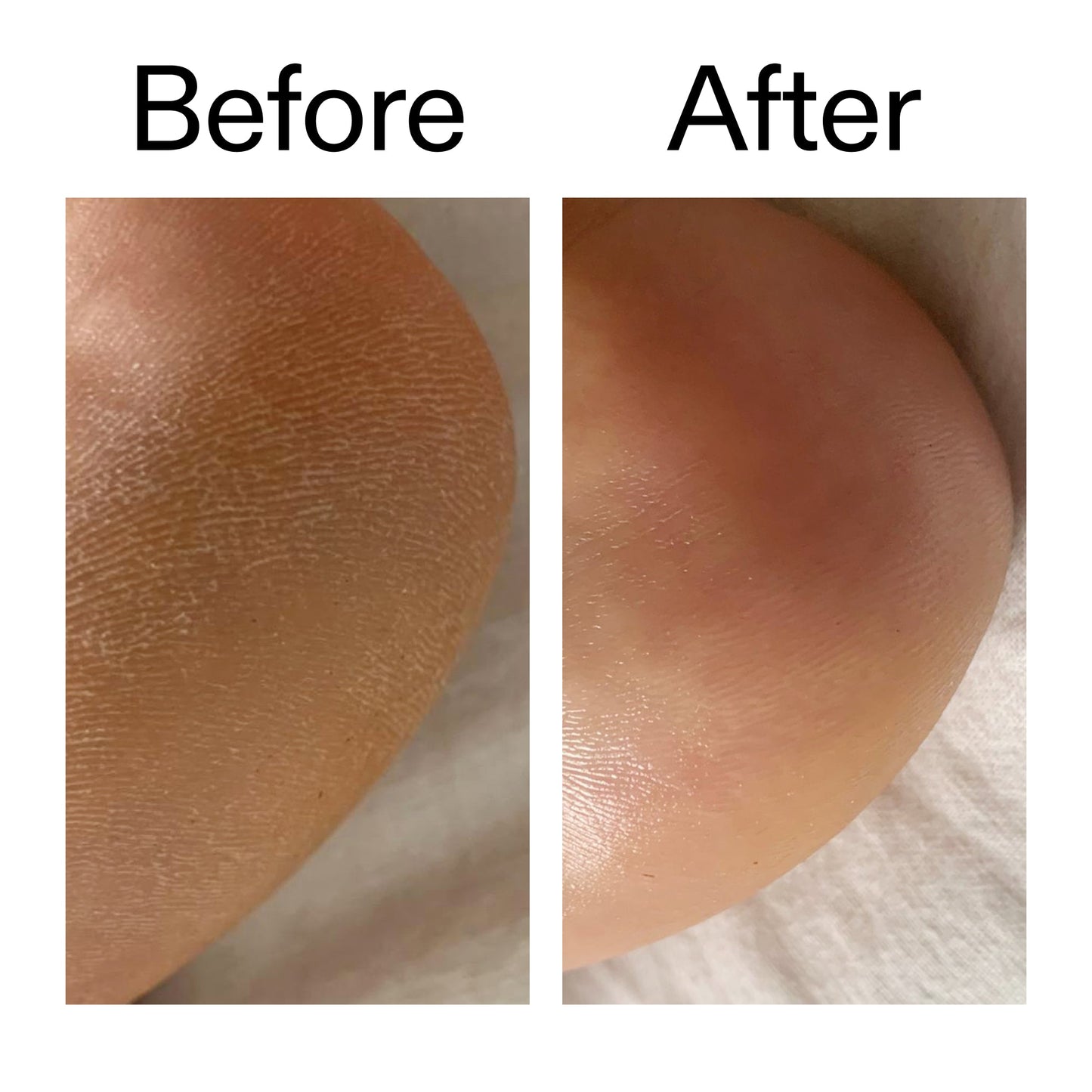 glycolic-acid-exfoliating-body-stick-e2 Glycolic_Acid_Exfoliating_Body_Stick_Before_After_V1_2000x2000_a3043625-9400-429a-a7fb-d6dbd220f722.jpg