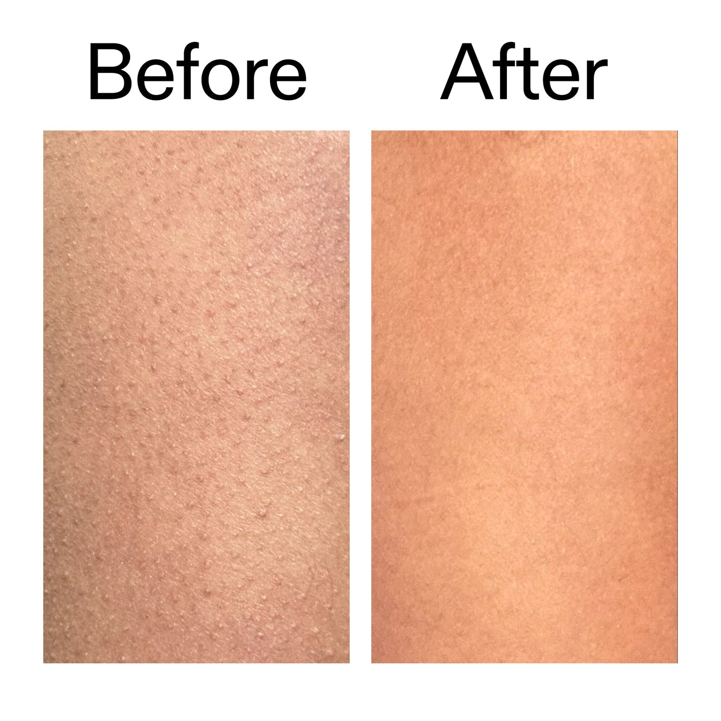 glycolic-acid-exfoliating-body-stick-e2 Glycolic_Body_Stick_B_A_2000x2000_6e6e6b4d-5bd7-43c0-aeed-4d66788e8995.jpg