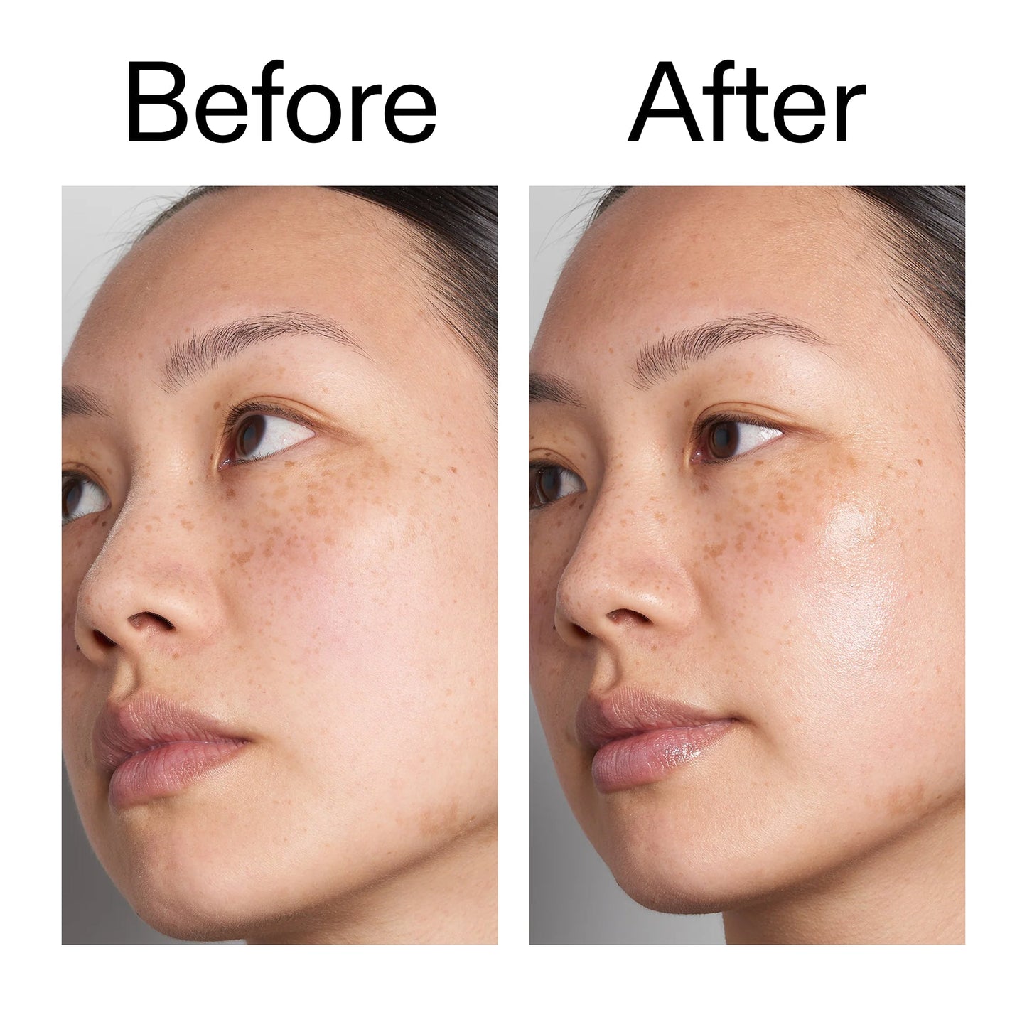 supersize-hyaluronic-acid-serum-100ml-k8 Hyaluronic_Acid_Before_After_2000x2000_d7983956-8aa2-4ea3-8255-c63e8d4f892e.jpg