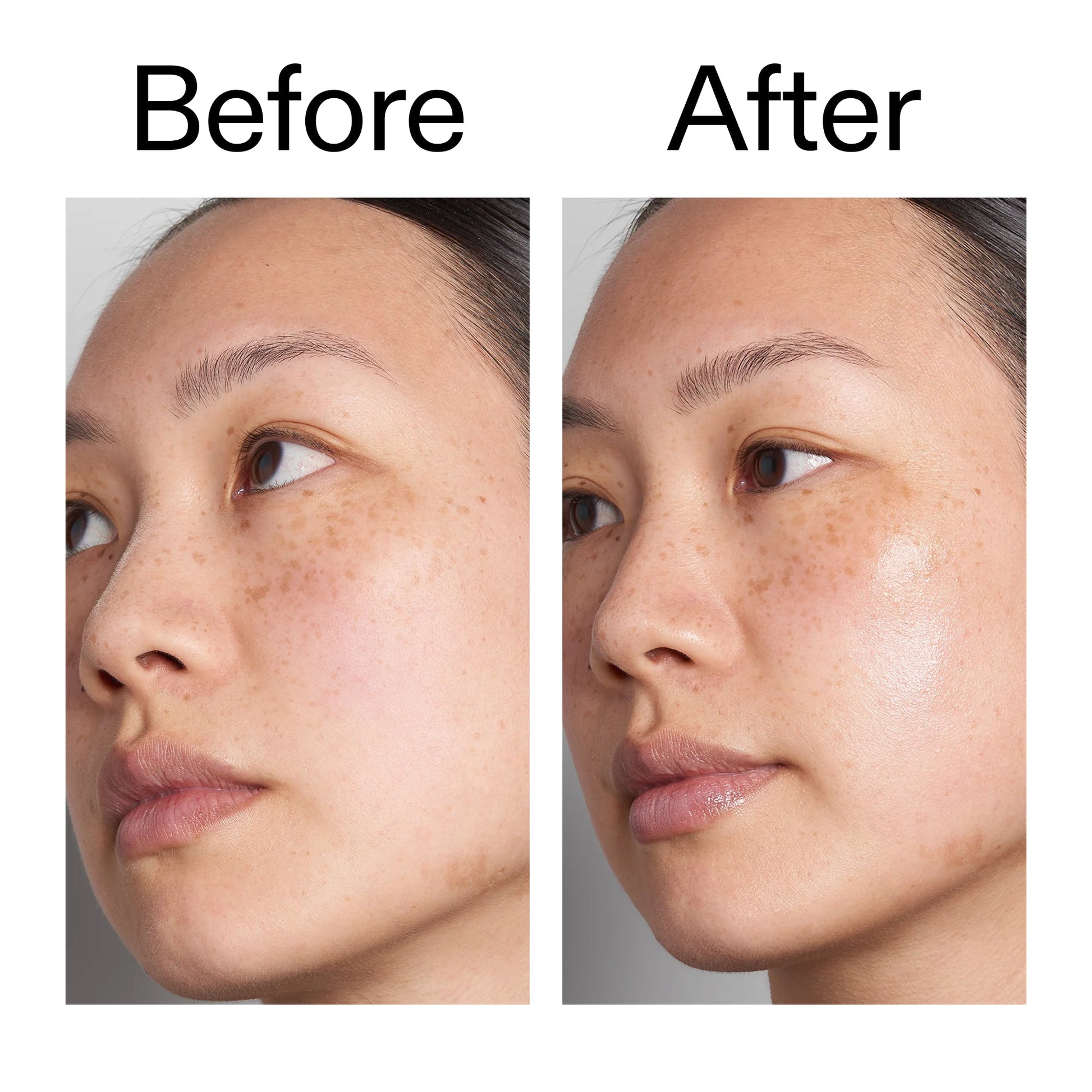 supersize-hyaluronic-acid-serum-100ml-k8 Hyaluronic_Acid_Before_After_2000x2000_d7983956-8aa2-4ea3-8255-c63e8d4f892e.jpg