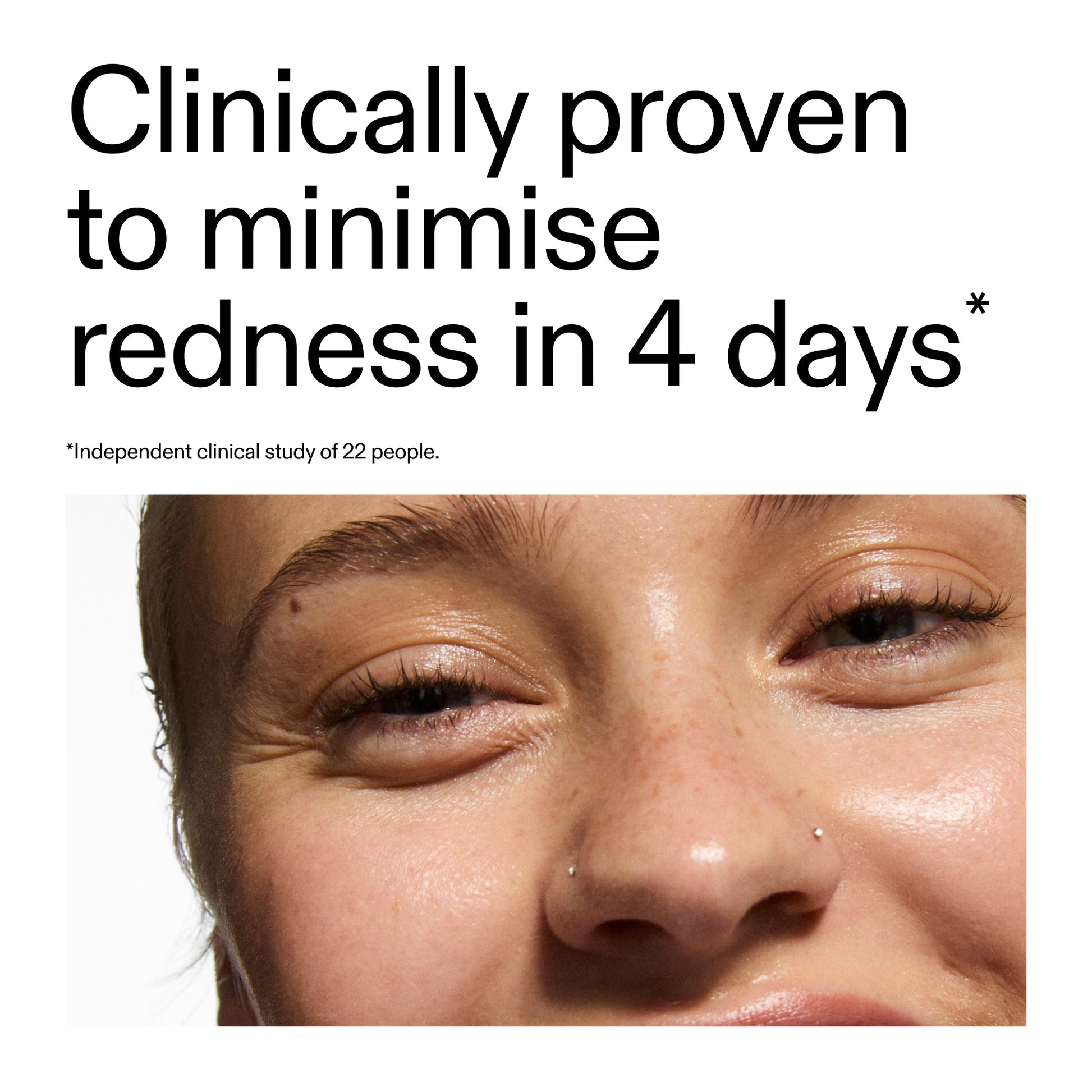 10-azelaic-acid-serum-for-redness-relief-y3 Oat_Cleansing_Balm_Claim_2000x2000_52a841dc-353c-4f2c-8646-3aadb604507d.jpg
