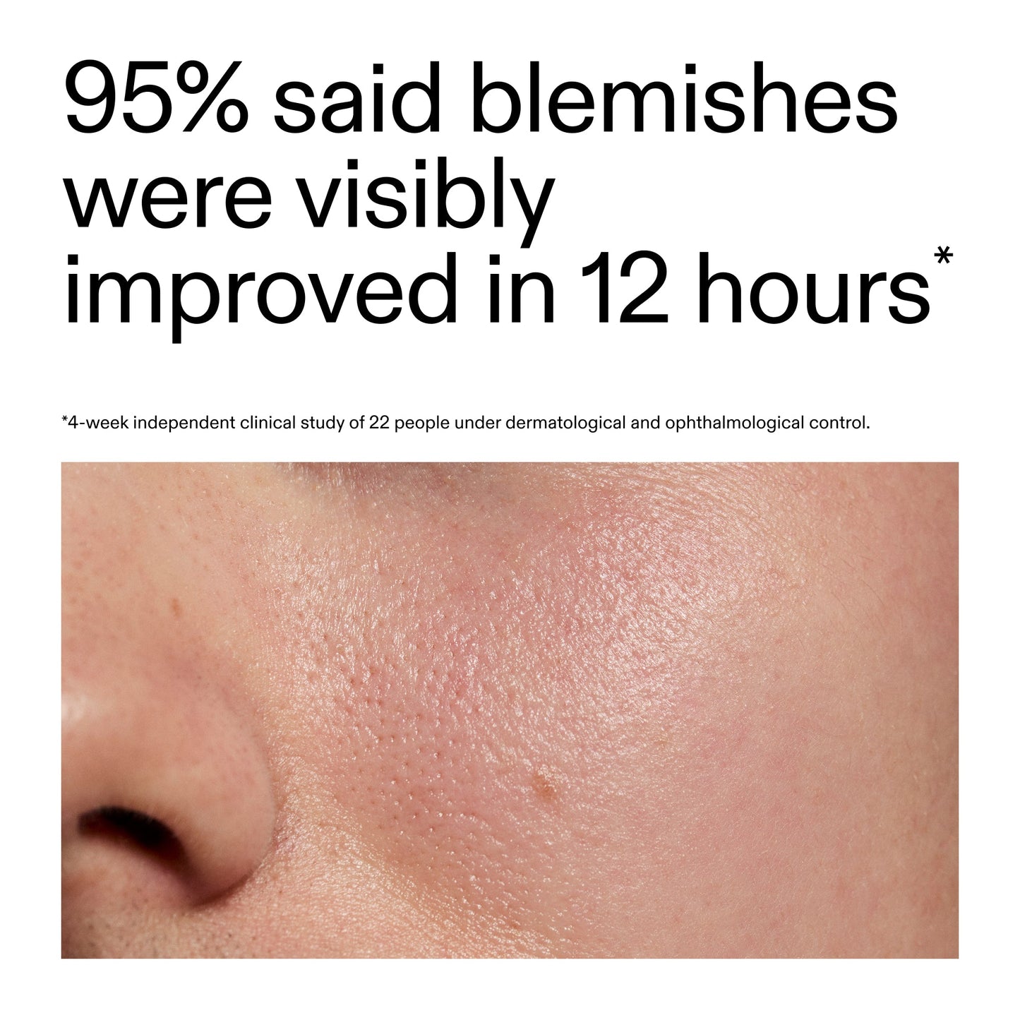 succinic-acid-acne-treatment-w2 Oat_Cleansing_Balm_Claim_2000x2000_ac6ce553-25db-41b2-a981-faae1ac4b8c0.jpg