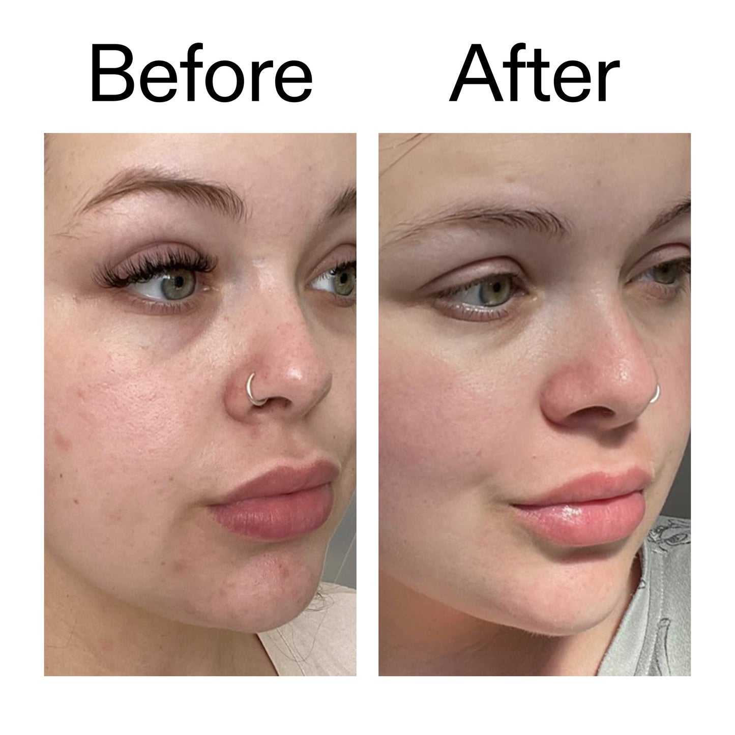 supersize-omega-water-cream-100ml-x9 Omega50_Before_After_2000x2000_46483ed8-3f9d-487f-9a0c-9df79830bd65.jpg