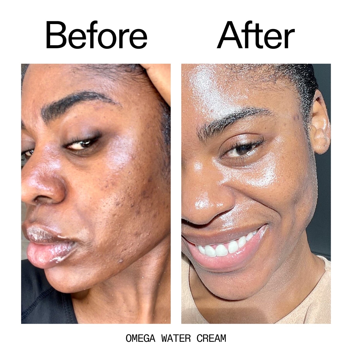 hydrating-cleanser-and-moisturizer-duo-z4 Omega_Water_Cream_Before_After_2000x2000_8e88278b-8c8d-48dc-ac77-4e98ebbd1b77.jpg
