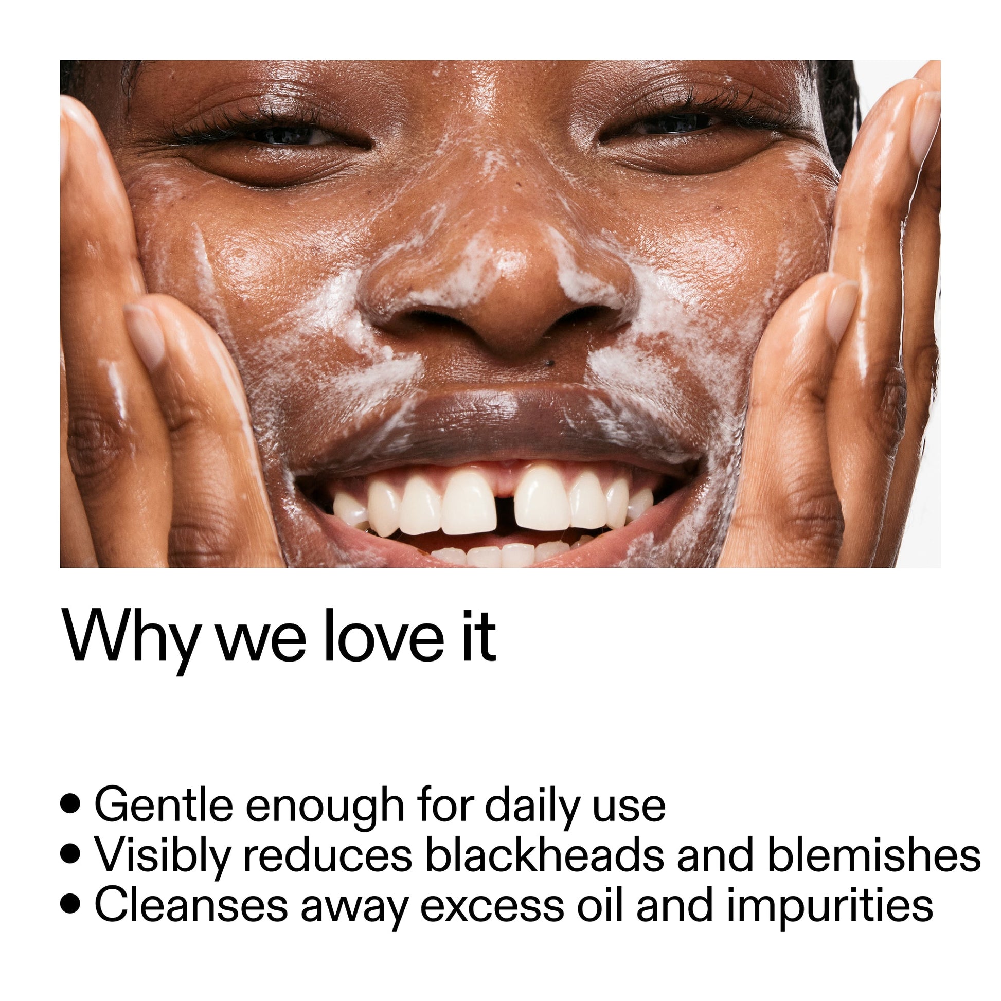 salicylic-acid-cleanser-duo-f1 Salicylic_Acid_Cleanser_-_300mlWhy_we_love_it_2000x2000_87dc92a9-2559-4309-98cd-4e570f1be735.jpg