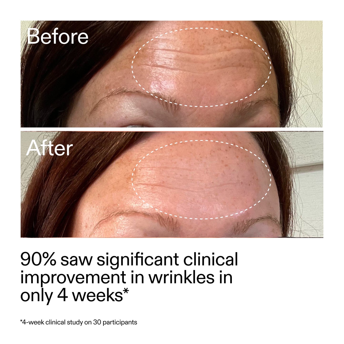 starter-retinol-serum-e8 StarterRetinol_BeforeAfter_Claim1_2000x2000_a09b50b6-4688-4527-abae-21bd142b89b7.jpg