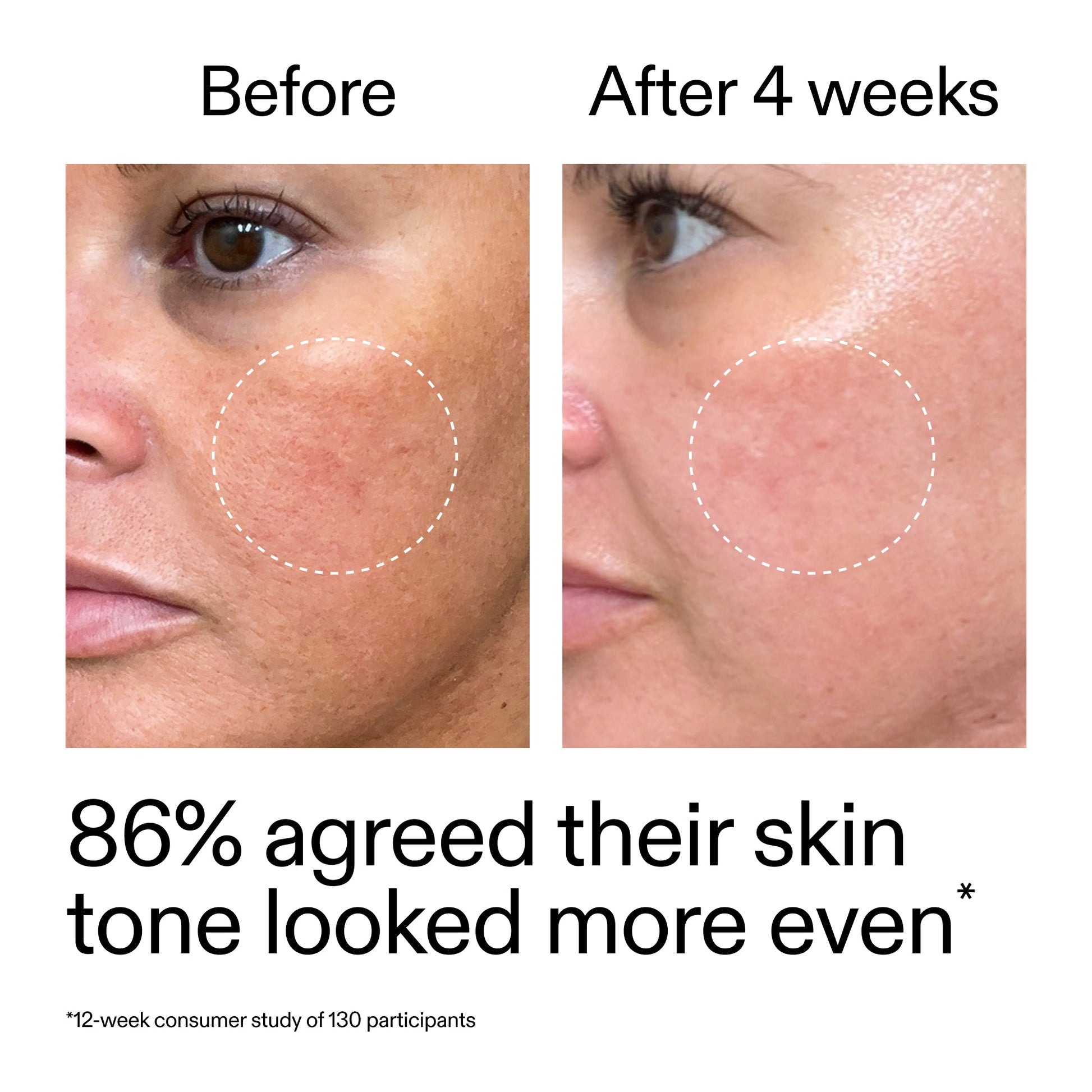 starter-retinol-serum-e8 StarterRetinol_BeforeAfter_Claim2_2000x2000_f5c9ecc0-8d76-429d-bef5-c3a61bcf5c09.jpg