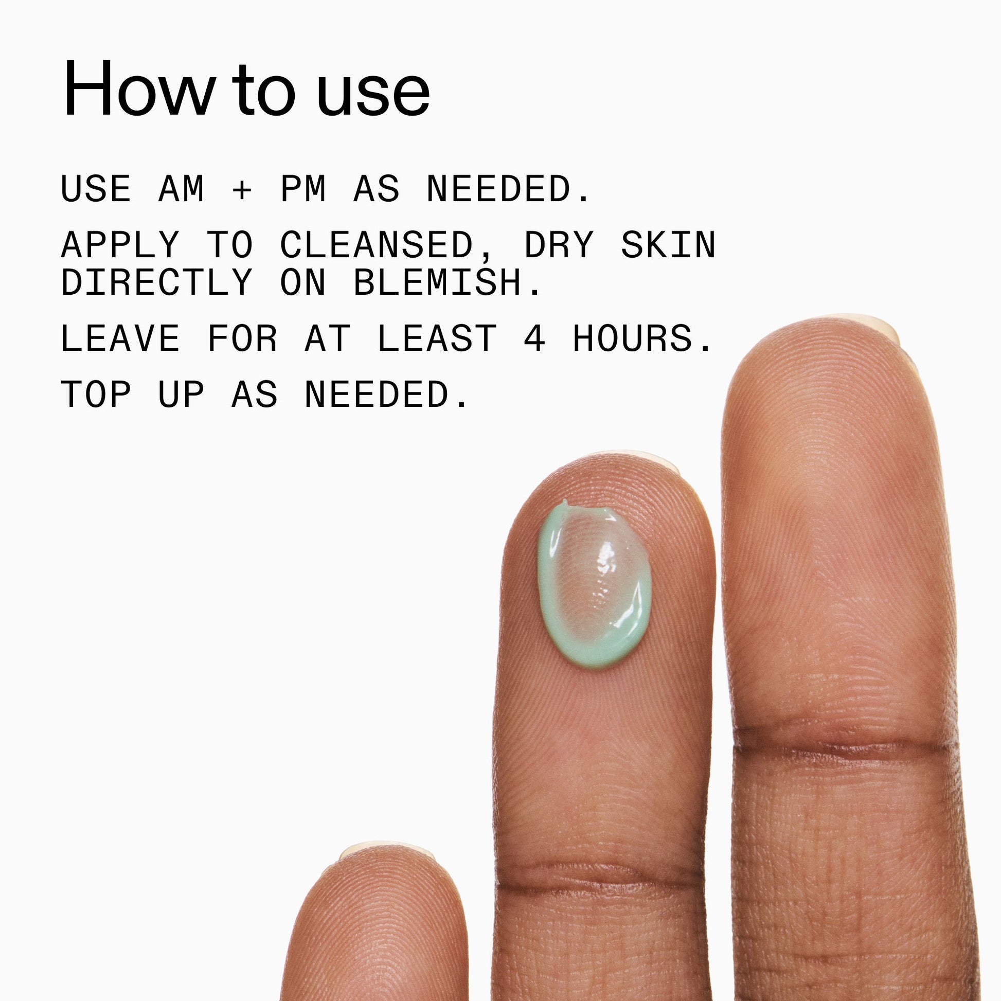succinic-acid-acne-treatment-w2 Succinic_Acid_Treatment_How_to_Use_2000x2000_d57137d5-d7f1-427c-9a46-5fc00c19c542.jpg