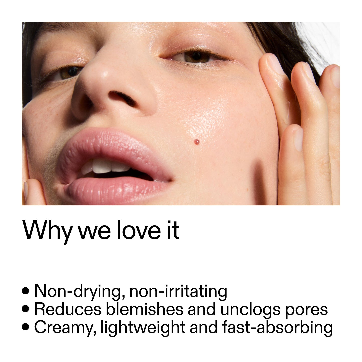 succinic-acid-acne-treatment-w2 Succinic_Acid_Treatment_Why_we_love_it_2000x2000_e90dd42a-cfe9-48b5-a2c7-d5eda787a6a8.jpg