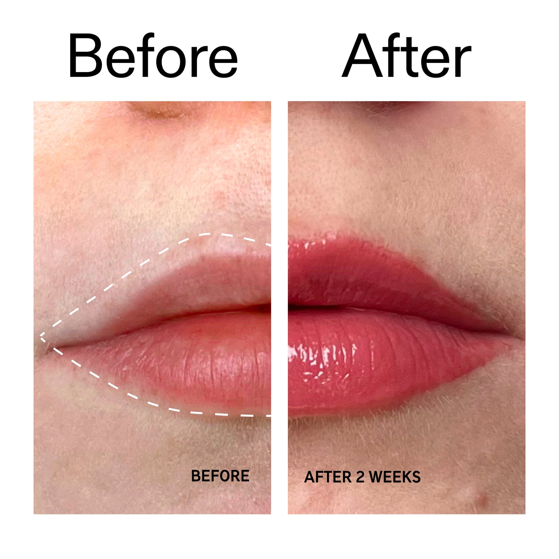 tripeptide-plumping-berry-lip-balm-i7 Tripeptide_Plumping_Lip_Balm_-_Berry_Before_After_2000x2000_9474bbd8-43ca-4b0e-b0e7-dfab70b91927.jpg