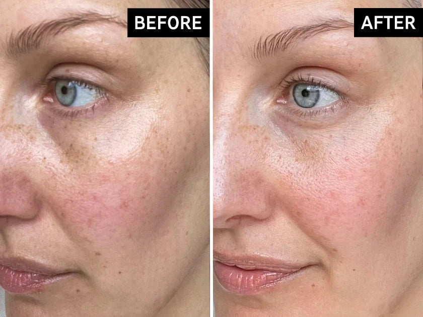 Before and after skin results